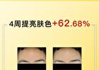 Tranexamic Acid Serum - 3 Sizes - 50ml