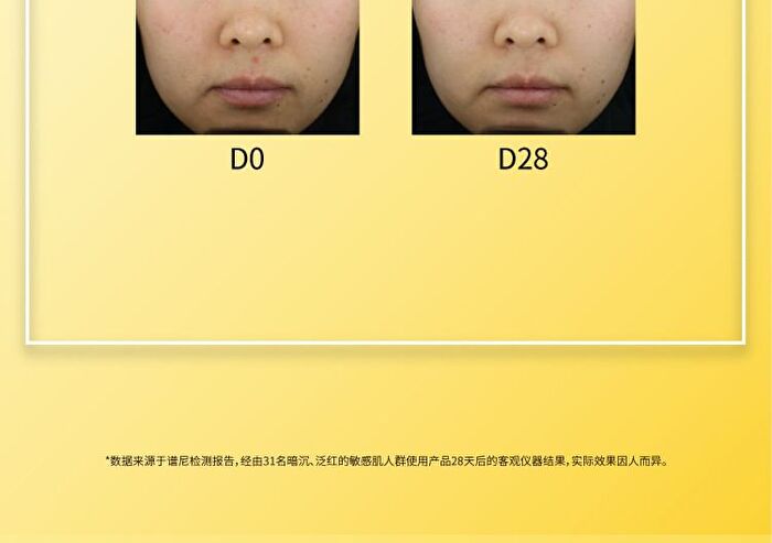 Tranexamic Acid Serum - 3 Sizes - 50ml