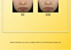 Tranexamic Acid Serum - 3 Sizes - 50ml