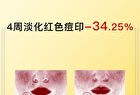 Tranexamic Acid Serum - 3 Sizes - 50ml
