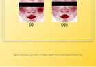 Tranexamic Acid Serum - 3 Sizes - 30ml