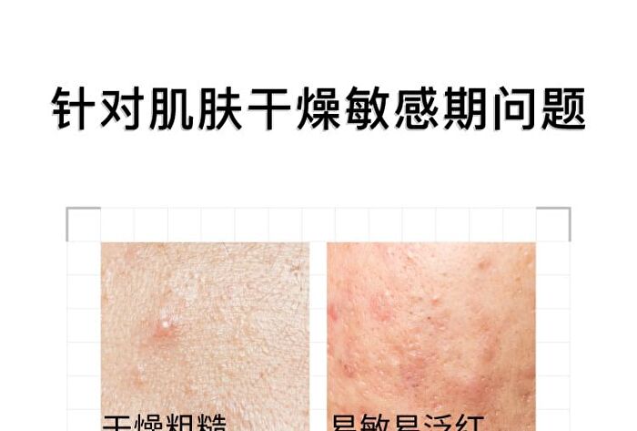 10% Vitamin B5  Serum - 2 Types - 15ml