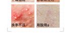 10% Vitamin B5  Serum - 2 Types - 15ml