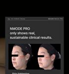 Nmode Pro Esther Bunny Edition - 1 Set