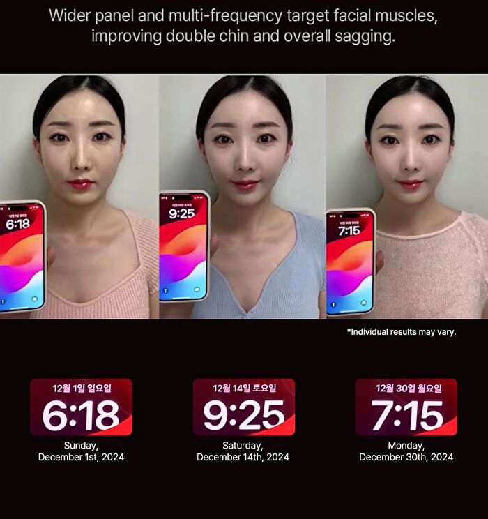 Nmode Pro Esther Bunny Edition - 1 Set