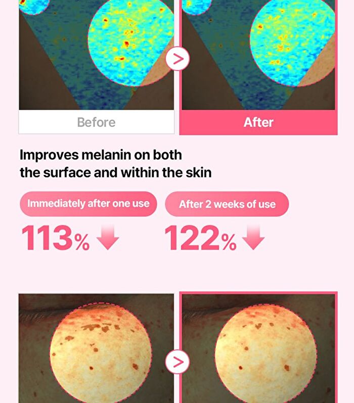 Re:dence Tone & Spot Perfect Glow Mask - 25ml x 1 sheet
