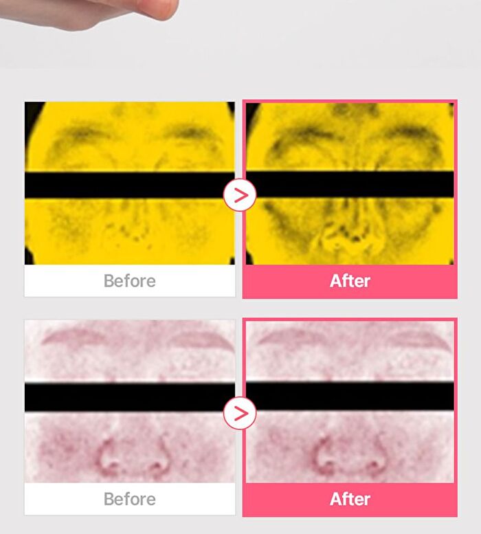 Re:dence Tone & Spot Perfect Glow Mask - 25ml x 1 sheet