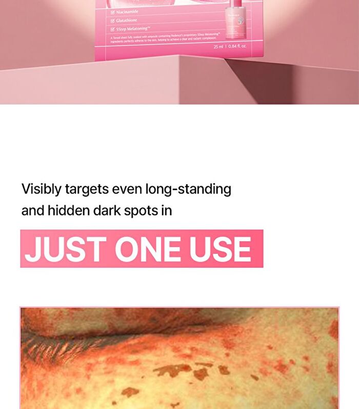 Re:dence Tone & Spot Perfect Glow Mask - 25ml x 1 sheet