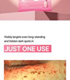 Re:dence Tone & Spot Perfect Glow Mask - 25ml x 1 sheet
