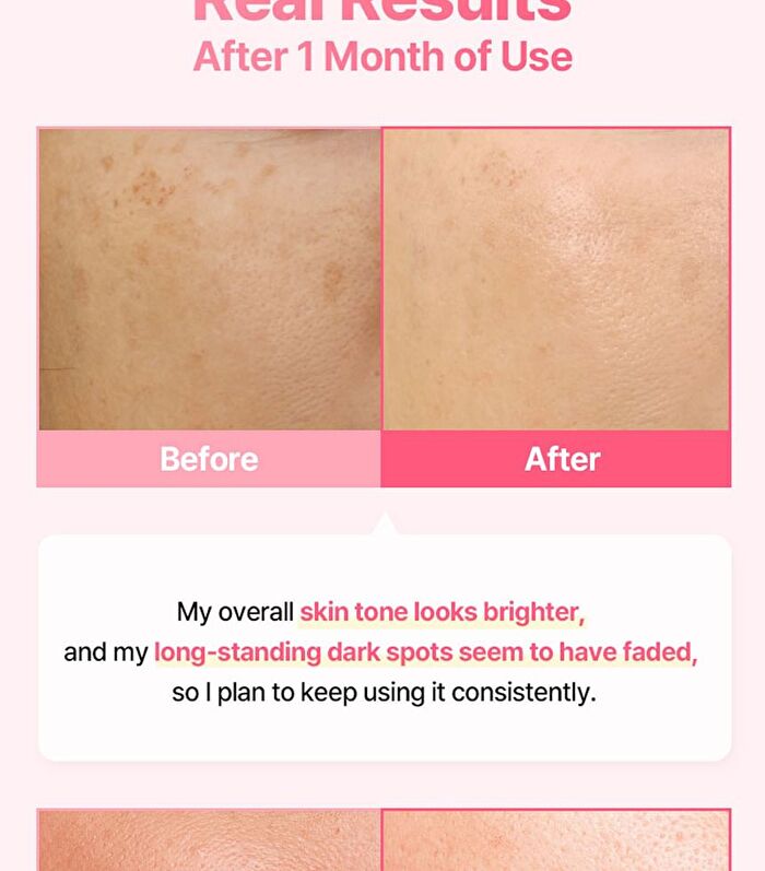 Re:dence Tone & Spot Perfect Glow Mask - 25ml x 1 sheet
