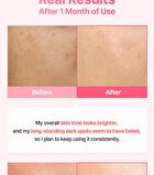Re:dence Tone & Spot Perfect Glow Mask - 25ml x 1 sheet