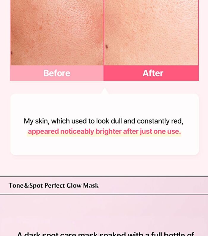 Re:dence Tone & Spot Perfect Glow Mask - 25ml x 1 sheet
