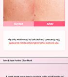 Re:dence Tone & Spot Perfect Glow Mask - 25ml x 1 sheet