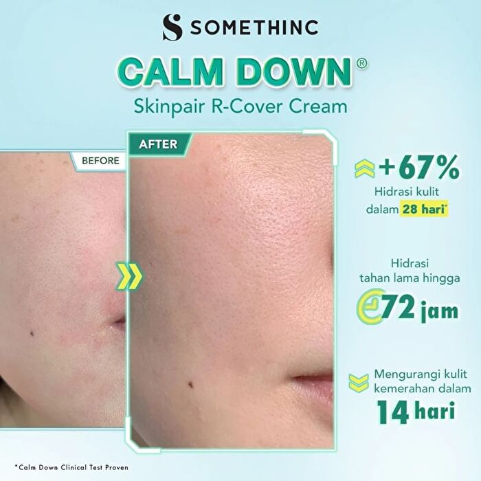 Somethinc Calm Down! Skinpair R-Cover Cream - 25g