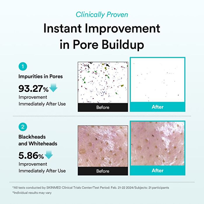 Green LHA Pore Pad Clear Touch - 2026 Version - 70 pads
