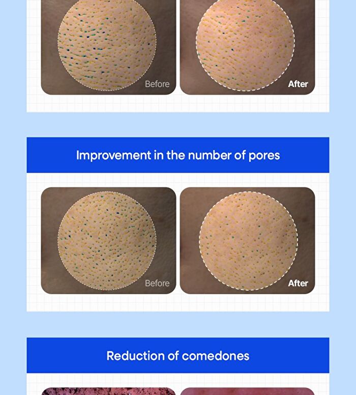 Blue Aloe Calming Pore Pad - 70 pads