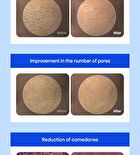Blue Aloe Calming Pore Pad - 70 pads