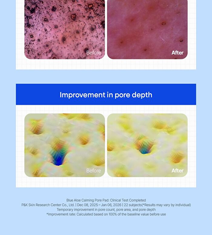 Blue Aloe Calming Pore Pad - 70 pads