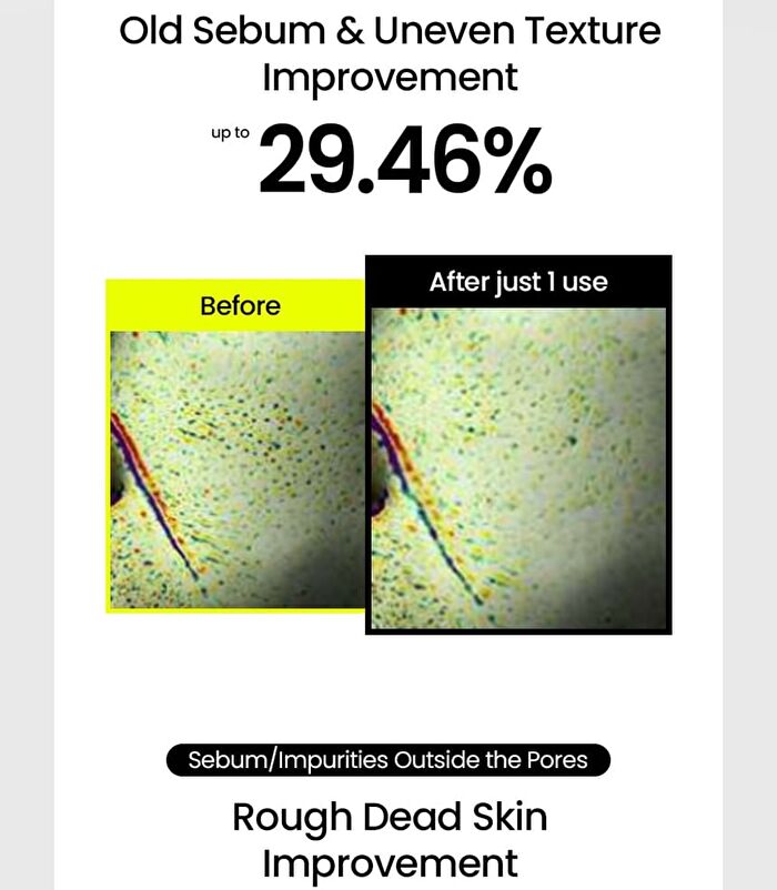 Mung Bean Pore Scaling Water Set - 3 pcs