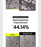 Mung Bean Pore Scaling Water - 150ml