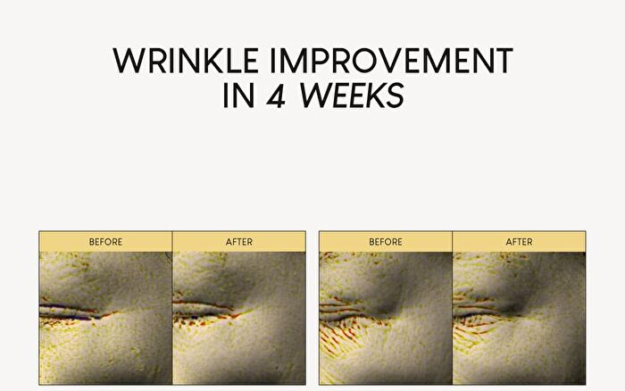 Firming Microdart Eye Patch with Bakuchiol, Niacinamide & Peptides - 1 Box (4 pairs)