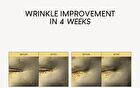 Firming Microdart Eye Patch with Bakuchiol, Niacinamide & Peptides - 1 Box (4 pairs)