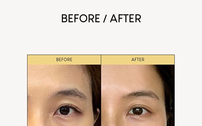 Firming Microdart Eye Patch with Bakuchiol, Niacinamide & Peptides - 1 Box (4 pairs)