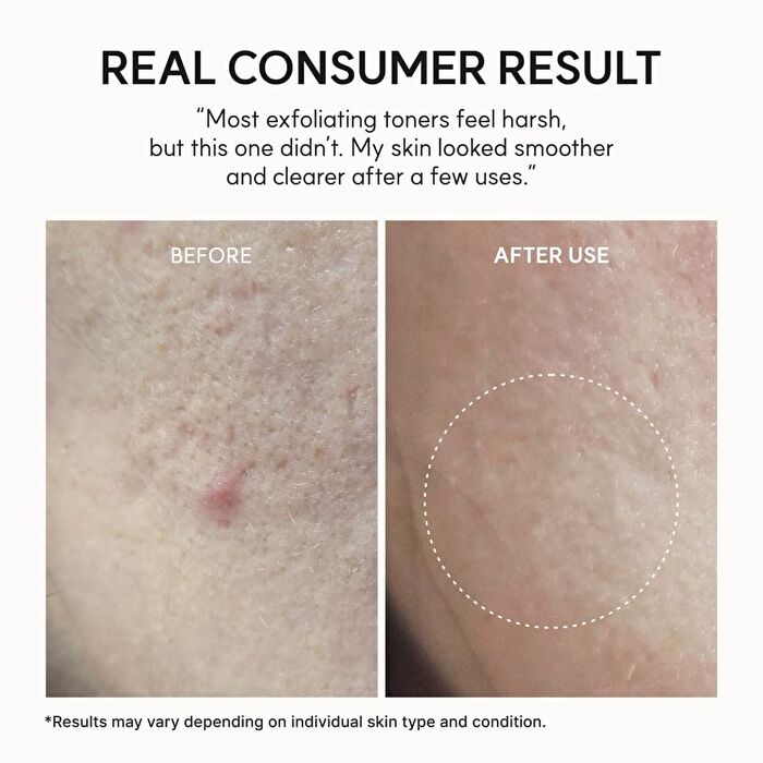 Eraser Shot Glycolic Acid Exfoliator - 200ml