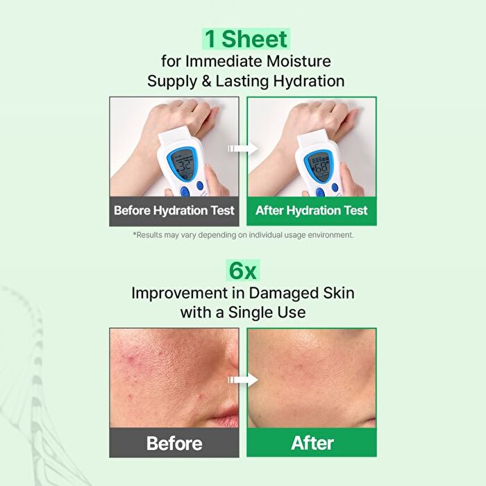EGF Skin Barrier Dressing Mask Pack Set - 23ml x 4 sheets