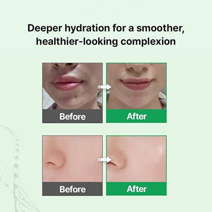 EGF Skin Barrier Hydro Ampoule - 30ml