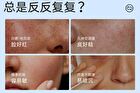 Rellet Moisturizing And Repairing Essence Lotion - 100g