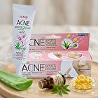 Isme Acne Spots Cream with Aloe Vera, Tea Tree Oil & Vitamin B6 - 10g