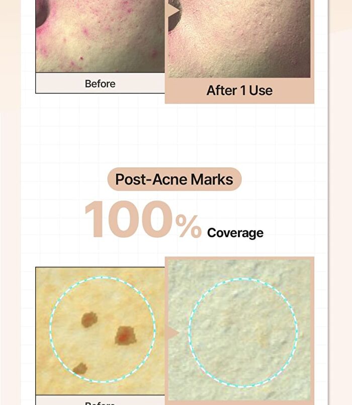 Daily Defense Supple Blemish Cream - 2 Colors - Natural Beige