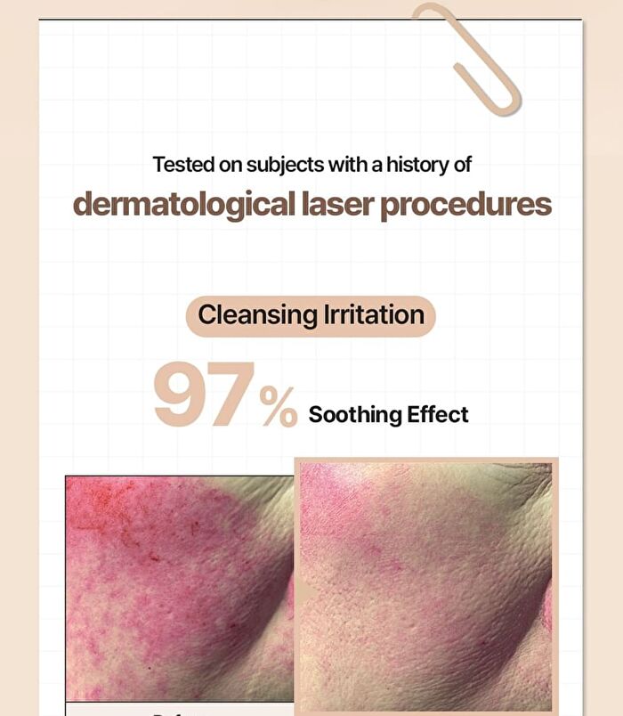 Daily Defense Supple Blemish Cream - 2 Colors - Natural Beige
