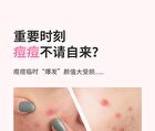 Yaozhi Cute Radiance Acne Pimple Patch (Trial Size)  - 12 Types - Baking Kitchen (12pcs)