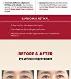 Ksecret YesStyle Exclusive SEOUL 1988 Eye Cream : Retinal Liposome 4% + Fermented Bean Mini - 10ml