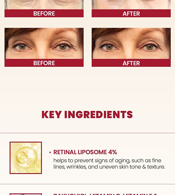 Ksecret YesStyle Exclusive SEOUL 1988 Eye Cream : Retinal Liposome 4% + Fermented Bean Mini - 10ml