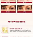 Ksecret YesStyle Exclusive SEOUL 1988 Eye Cream : Retinal Liposome 4% + Fermented Bean Mini - 10ml