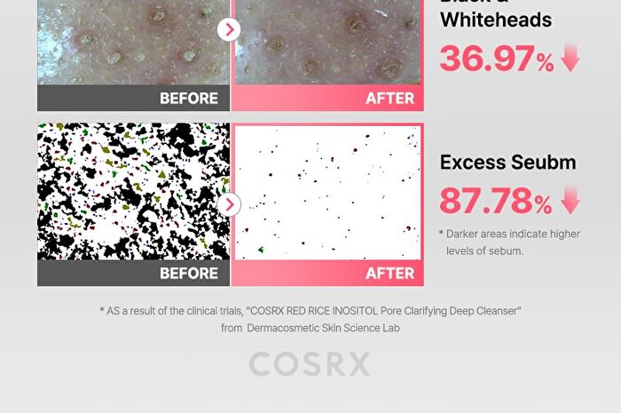 Cosrx Red Rice Inositol Pore Clarifying Deep Cleanser - 150ml