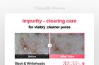 Cosrx Red Rice Inositol Exfoliating Care Pore Peel Serum - 80ml