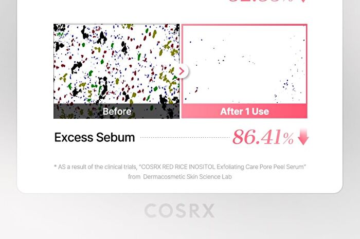 Cosrx Red Rice Inositol Exfoliating Care Pore Peel Serum - 80ml