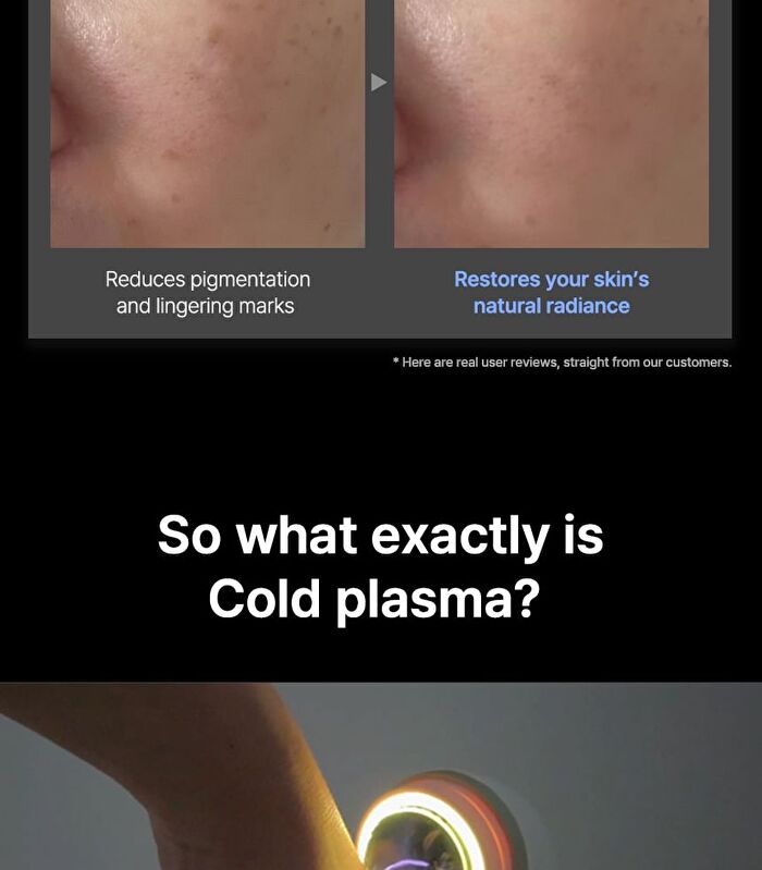 Planova - 1 Set