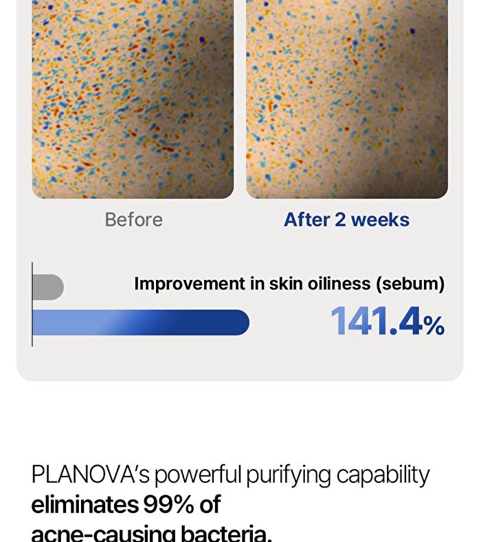 Planova - 1 Set