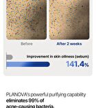 Planova - 1 Set