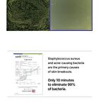 Planova - 1 Set