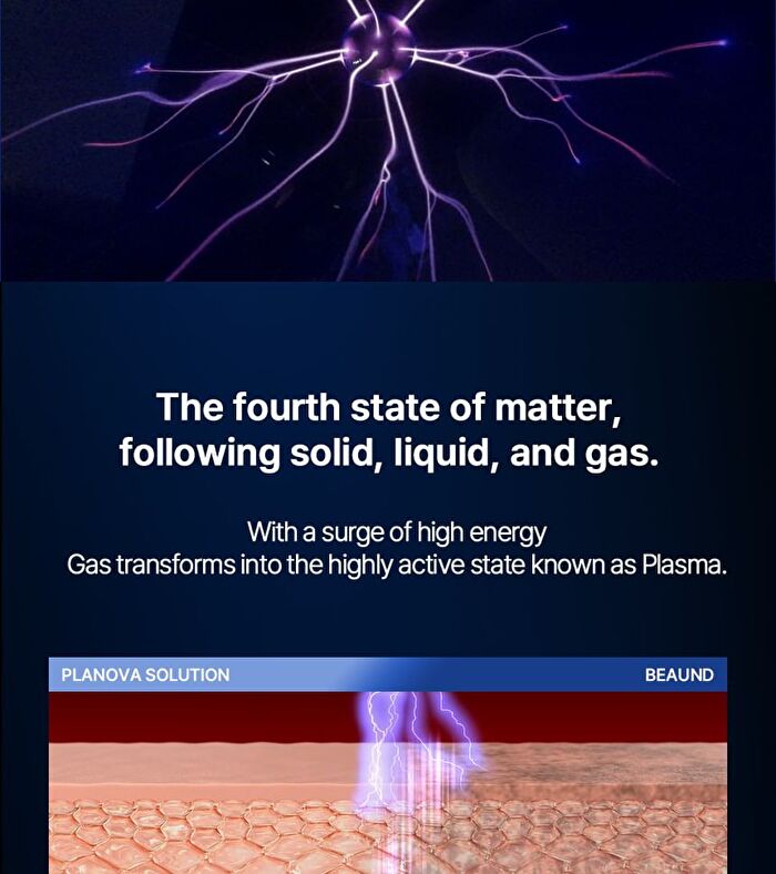 Planova - 1 Set