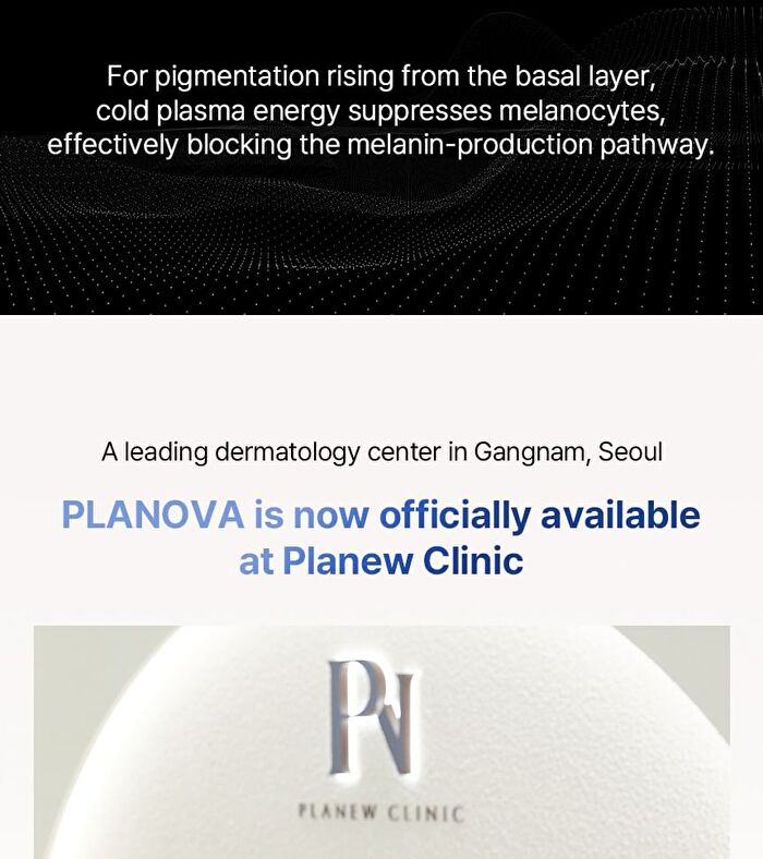 Planova - 1 Set