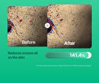 Hiffect Madeca Tea Tree Ampoule - 50ml