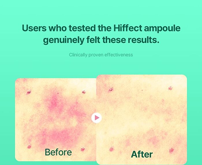 Hiffect Madeca Tea Tree Ampoule - 50ml