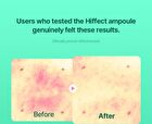Hiffect Madeca Tea Tree Ampoule - 50ml